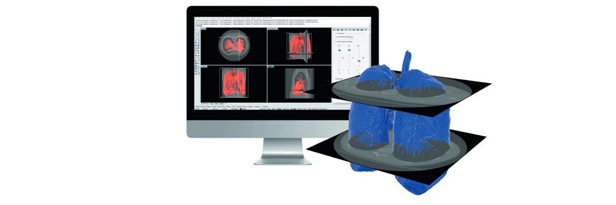 Rhino3DMedical